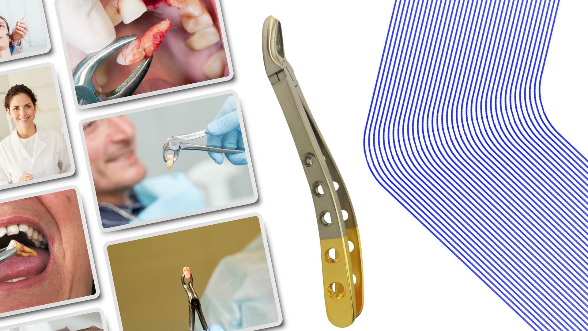 ErgoDenta extraction forceps range — Standard, Diamond and GripMaster series