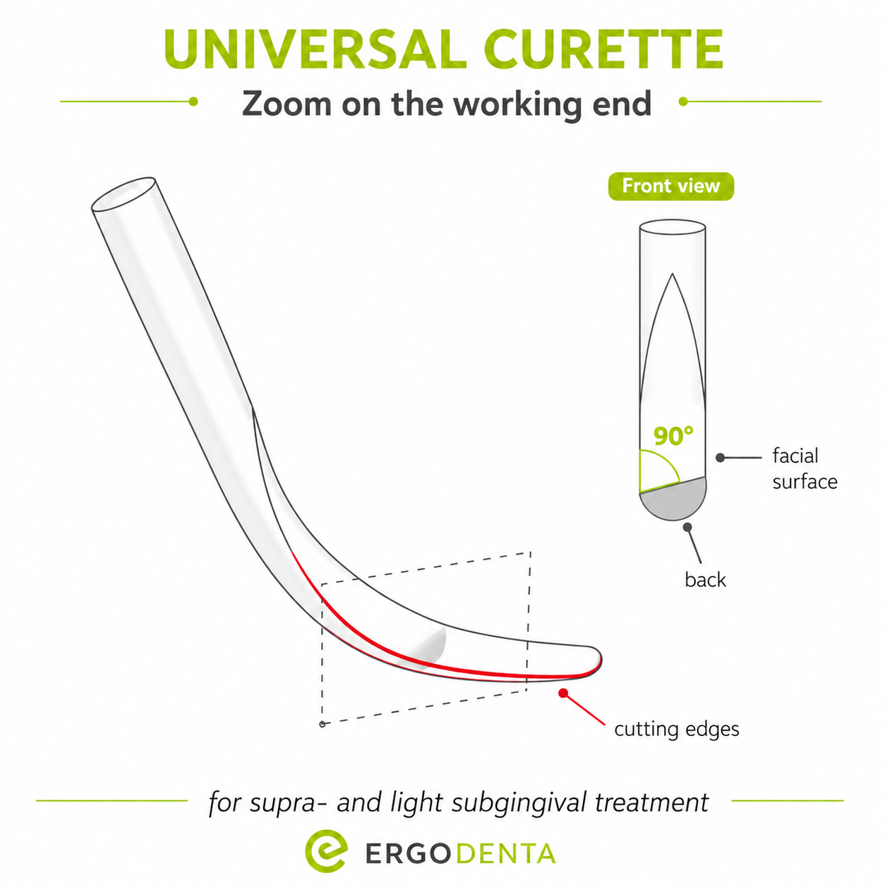 Universal Curette working end — 90° blade angle, two cutting edges, supragingival and light subgingival treatment